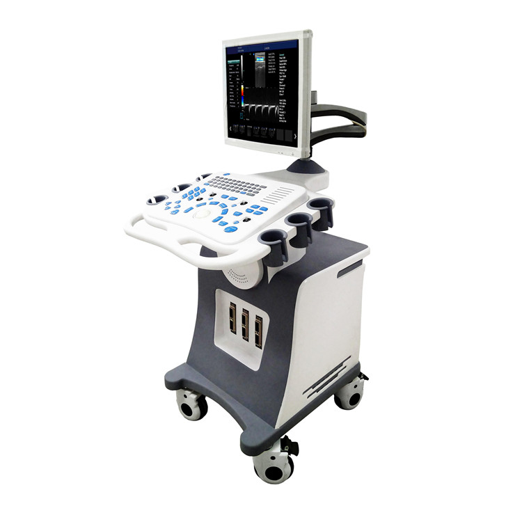 Vascular 4D Ultrasound Scanner Vascular 4D Ultrasound Scanner