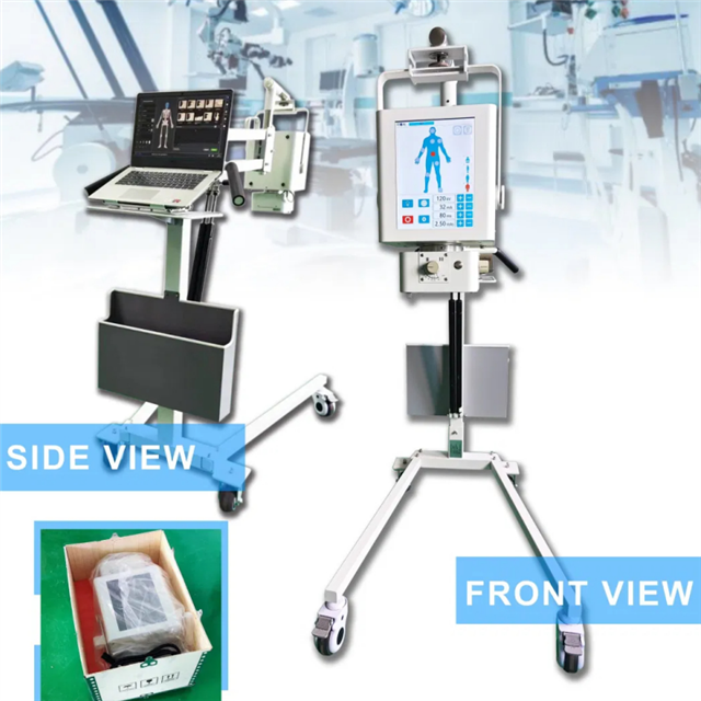 پورٹ ایبل ایکس رے مشین یونٹ