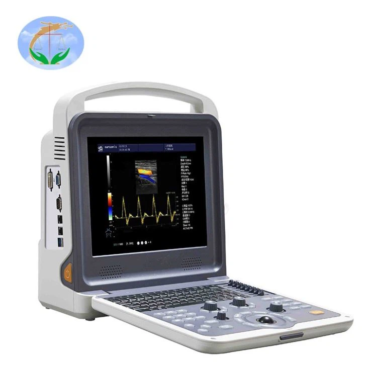 Color Doppler Ultrasound Scanner