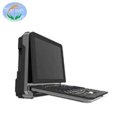 پورٹیبل رنگ ڈوپلر الٹراساؤنڈ