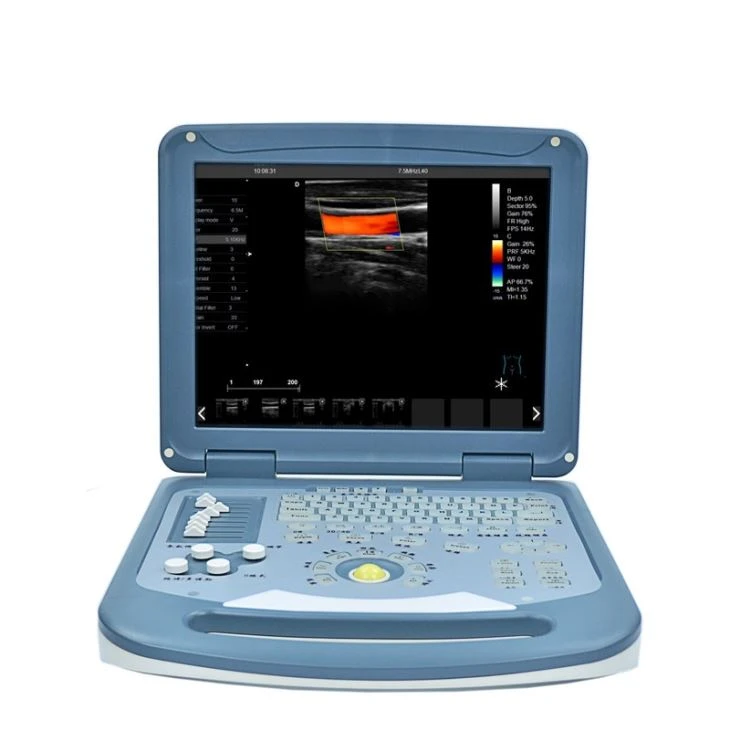 Ultrasound Scanner Factory Price Ultrasound Scanner Factory Price