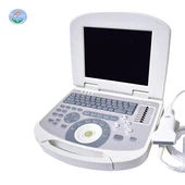 پورٹ ایبل الٹراساؤنڈ سکینر