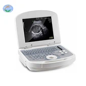 YJ-U308 China Portable Ultrasound Scanner