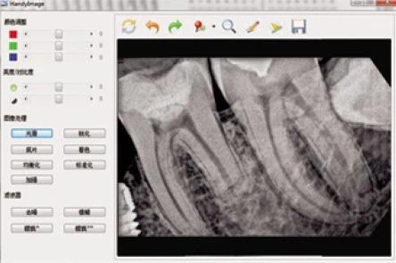 dental sensor (6) dental sensor (6)