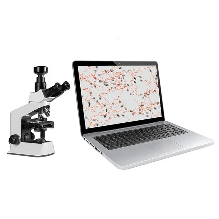 semen analyzer